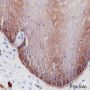 Anti-Keratin 5 Rabbit mAb