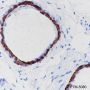 Anti-Keratin 5 Rabbit mAb