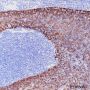 Anti-Keratin 5 Rabbit mAb