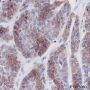 Anti-Keratin 5 Rabbit mAb