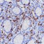 Anti-CD8 alpha Rabbit mAb