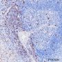 Anti-CD8 alpha Rabbit mAb