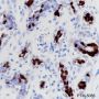 Anti-Progesterone Receptor Rabbit mAb