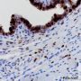 Anti-Progesterone Receptor Rabbit mAb