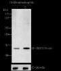Anti-Crotonyl-Histone H2B (Lys12) Rabbit pAb