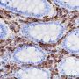 Anti-CD38 Rabbit mAb