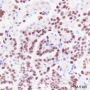 Anti-TTF1 Rabbit mAb