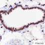 Anti-TTF1 Rabbit mAb