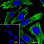 Anti-Keratin 8 Mouse mAb