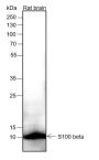 Anti-S100B Rabbit mAb