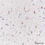 Anti-S100B Rabbit mAb