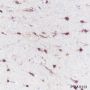 Anti-S100B Rabbit mAb
