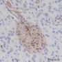 Anti-PTEN Rabbit mAb