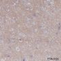 Anti-CD47 Rabbit mAb