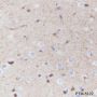 Anti-S100B Rabbit mAb