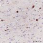 Anti-S100B Rabbit mAb
