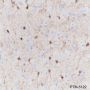 Anti-S100B Rabbit mAb