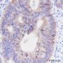 Anti-Claudin-1 Rabbit mAb
