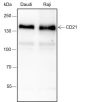 Anti-CD21 Rabbit mAb