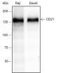 Anti-CD21 Rabbit mAb