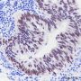 Anti-SATB2 Rabbit mAb