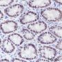 Anti-SATB2 Rabbit mAb