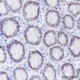 Anti-SATB2 Rabbit mAb