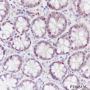 Anti-FOXP1 Rabbit mAb