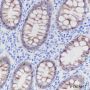 Anti-Cadherin-17 Rabbit mAb