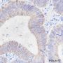 Anti-Cadherin-17 Rabbit mAb