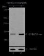 Anti-Crotonyl-Histone H2B (Lys34) Rabbit pAb