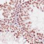 Anti-Dimethyl-Histone H3 (Lys79) Mouse mAb
