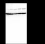 Anti-ATP5A1 Mouse mAb