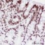 Anti-Crotonyl-Histone H3 (Lys9) Rabbit mAb