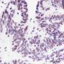 Anti-Crotonyl-Histone H3 (Lys18) Rabbit pAb