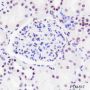 Anti-Crotonyl-Histone H3 (Lys18) Rabbit pAb