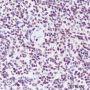 Anti-Crotonyl-Histone H3 (Lys18) Rabbit pAb