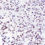 Anti-Crotonyl-Histone H3 (Lys18) Rabbit pAb