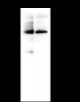 Anti-PPP3CB Mouse mAb