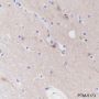Anti-PPP3CB Mouse mAb