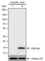 Anti-Crotonyl-Histone H3 (Lys18) Rabbit mAb
