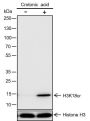 Anti-Crotonyl-Histone H3 (Lys18) Rabbit mAb
