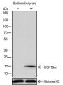 Anti-Crotonyl-Histone H3 (Lys18) Rabbit mAb