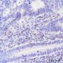 Anti-CD8 alpha Mouse mAb