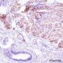 Anti-Desmin Rabbit mAb