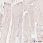 Anti-Desmin Rabbit mAb