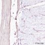 Anti-Desmin Rabbit mAb