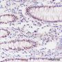 Anti-MSH6 Mouse mAb