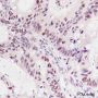 Anti-MSH6 Mouse mAb