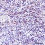 Anti-Bcl-2 Rabbit mAb
